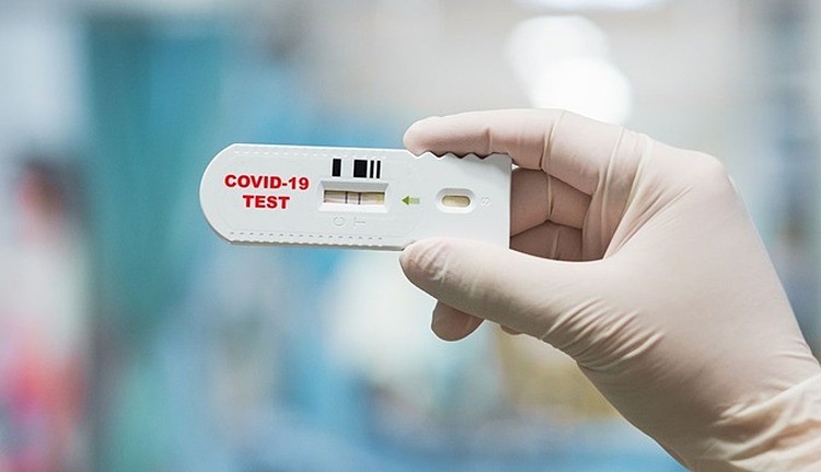 Miễn thuế nhập khẩu vật tư để sản xuất que test COVID-19