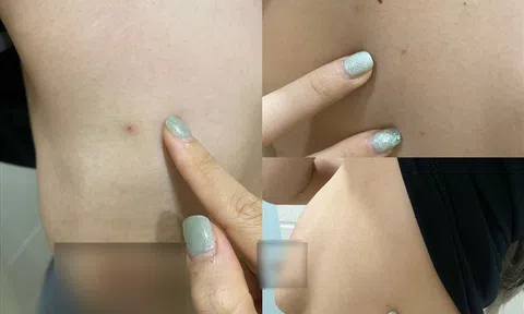 Hàng loạt điểm spa, thẩm mỹ viện sai phạm bị xử phạt