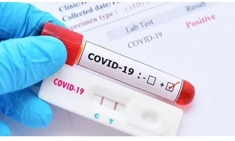 Các hãng dược phẩm đẩy mạnh phát triển thuốc điều trị và kit xét nghiệm COVID-19