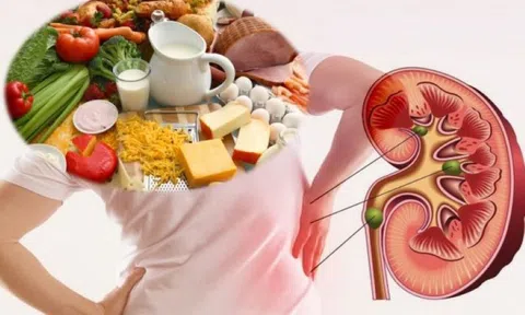 Các loại thực phẩm tăng cường sức khỏe thận