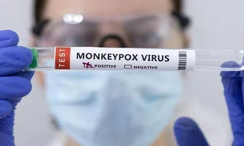 Ca bệnh đậu mùa khỉ đầu tiên ở Việt Nam thuộc chủng có nguồn gốc từ Tây Phi
