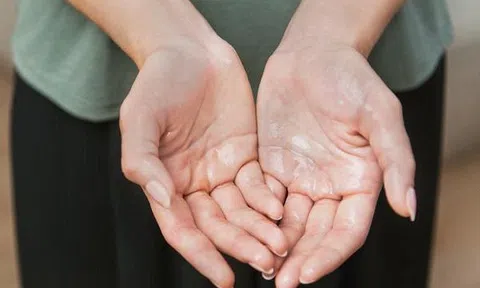 Đổ mồ hôi tay và những phương pháp khắc phục hiệu quả