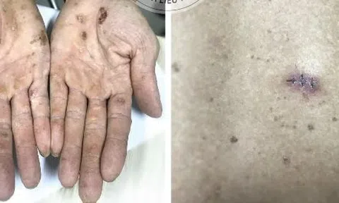 Thạch tín và những hiểu biết về chất này