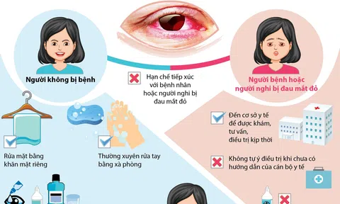 Làm gì khi bị đau mắt đỏ?